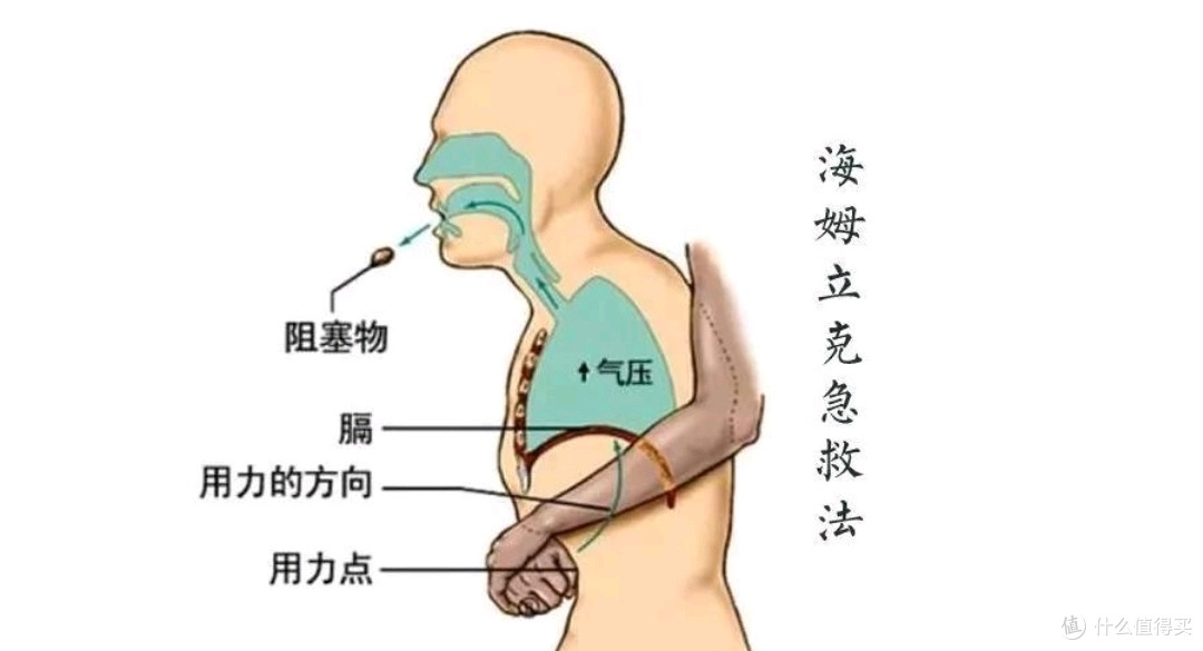 气道异物堵塞怎么办!黄金五分钟别错过,海姆立克急救法(必须收藏)_健