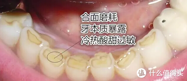 笑研所正畸科普：单颌可以矫正吗？