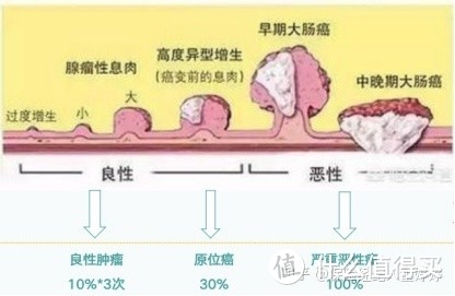 工银安盛御享颐生（尊享版）—“魔鬼”隐藏在细节中