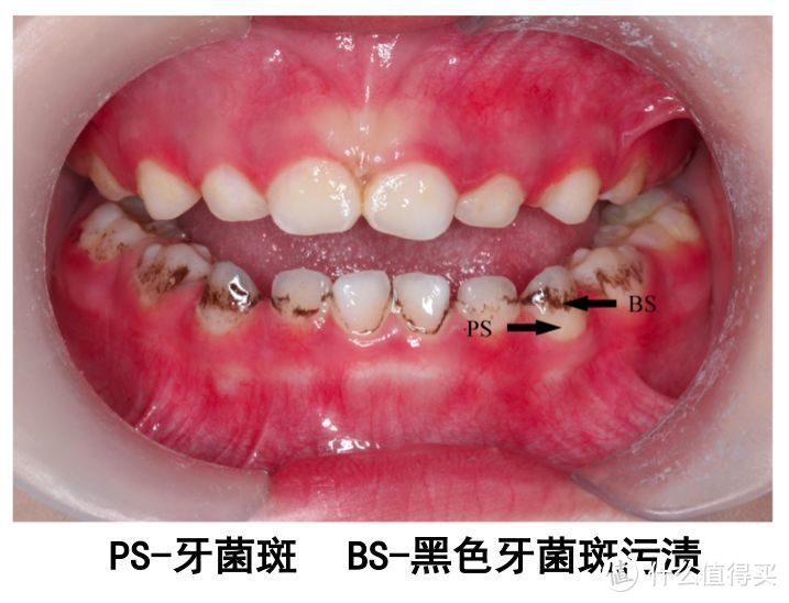 为什么这么多成人牙膏，就挑不出来一个好的？