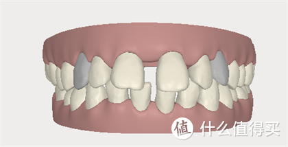 口臭、蛀牙、牙缺失　...成年人必须要了解的的这4种口腔项目