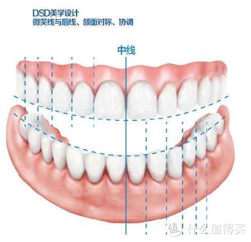 笑研所科普：丑小鸭变天鹅？正畸第一步！