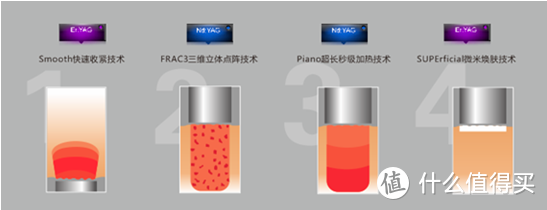 科普一个抗衰新项目，号称平价热玛吉的Fotona 4D