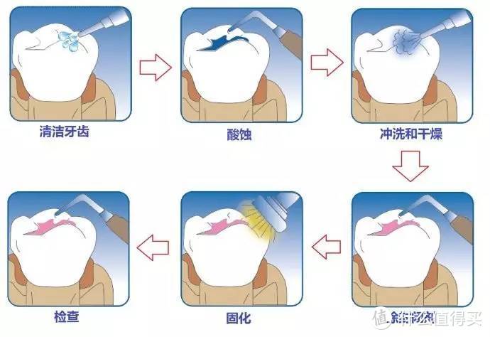 蛀牙、龅牙、地包天......孩童期必须重视的3个牙齿项目