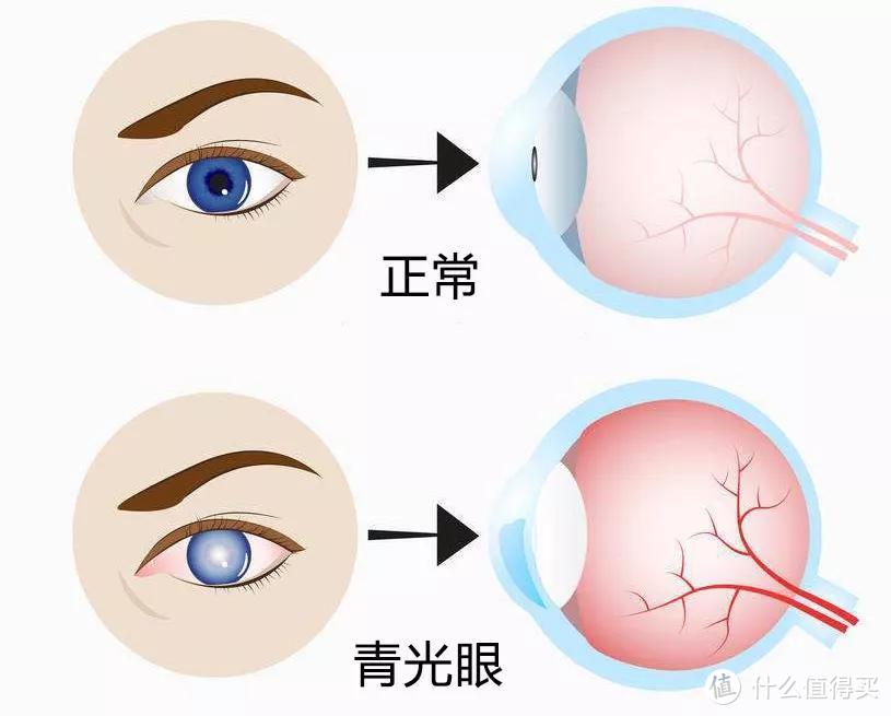 为什么有人看IMAX电影会头晕？关于眼科十条硬核知识！