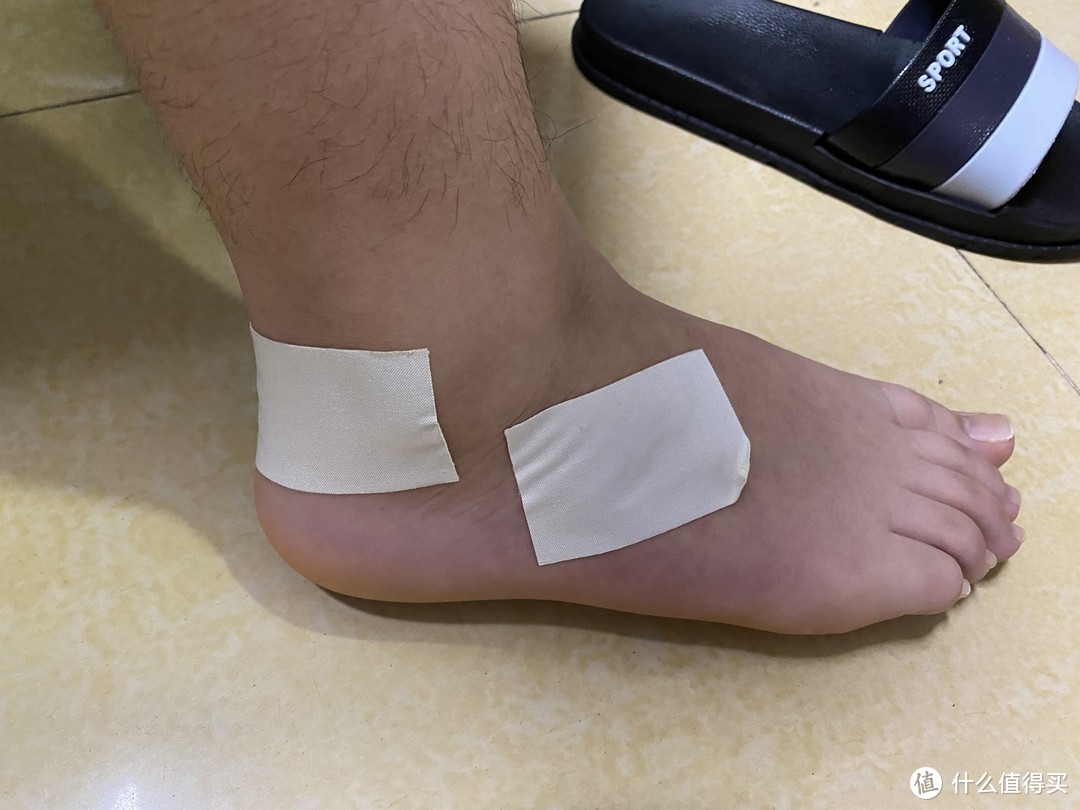 一下,现在有明显的红肿,她看了一下应该不是骨折,现在只贴了膏药处理