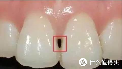 笑研所科普：什么样的牙算好看的？