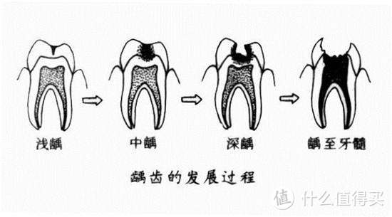 为什么你买了昂贵的电动牙刷，还是出现口腔问题？这个细节不能忽视