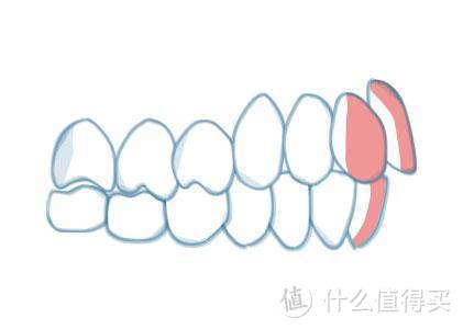 笑研所科普：口周美学