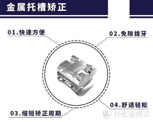 急！牙齿矫正前需要知道的小知识居然有这么多？速点击