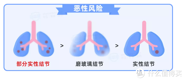 哪种肺结节最易癌变？体检查出肺结节，还能买什么保险？