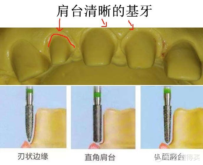 刃状肩台的图解图片