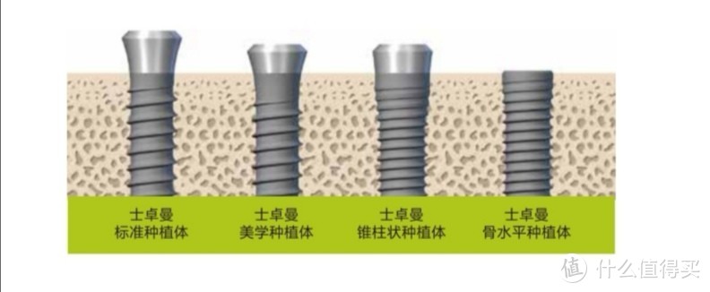 缺牙人士看过来：国际公认最稳定的种植体——士卓曼（ITI），究竟怎么样？