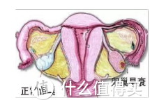  卵巢早衰早期症状有哪些该怎么调理