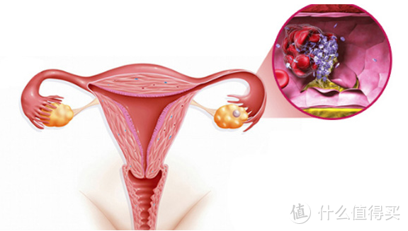 聪明女人需要了解：卵巢早衰是怎么引起的有哪些症状及危害