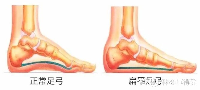 【跑者训练营】平足，要不要穿鞋？