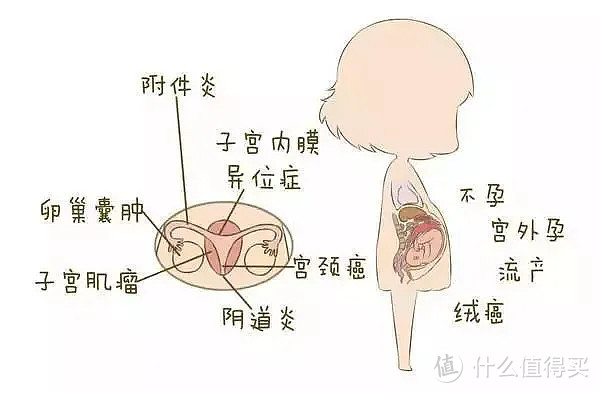 什么是子宫内膜异位症