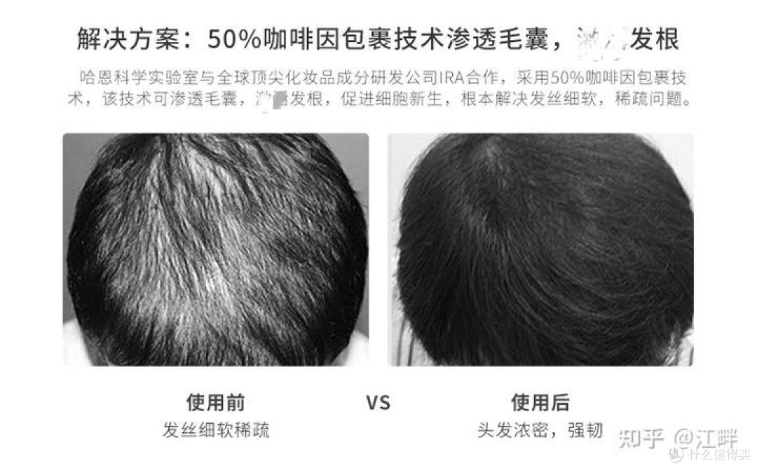 洗发水大合集，防脱、控油、去屑洗发水真实分享！