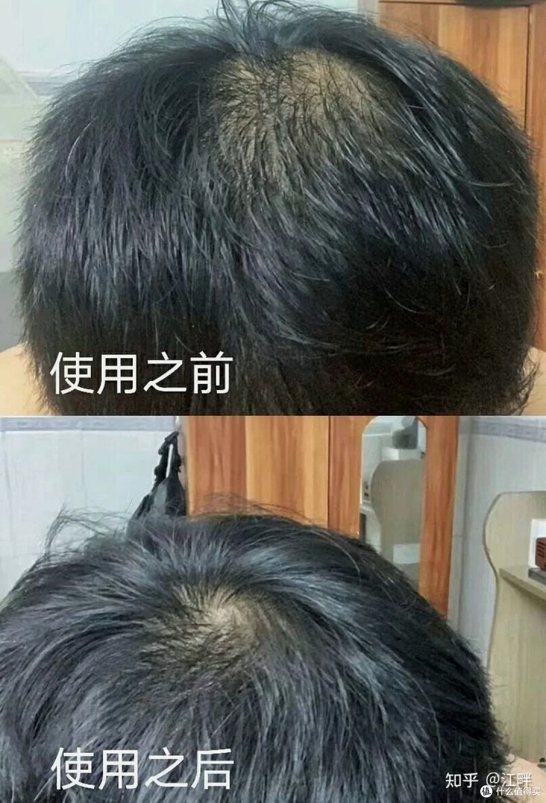 洗发水大合集，防脱、控油、去屑洗发水真实分享！