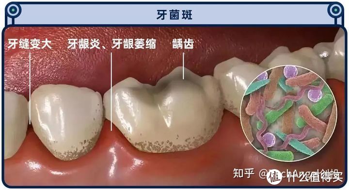 是否有必要购买飞利浦的电动牙刷？