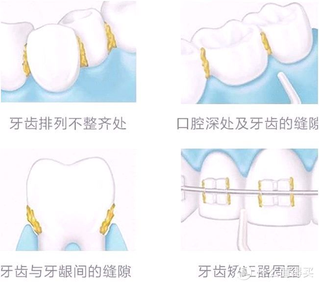 【口腔清洁篇一】：冲牙器有必要买吗？哪个牌子性价比高？此文全部解答~（内附性能价格对比）建议收藏！