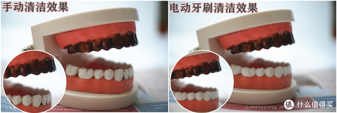 口腔师科普：电动牙刷和普通牙刷哪个好？