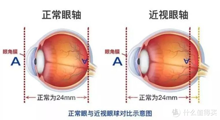 蔡司佳锐全链路线上配镜，给你不一样的新视界体验