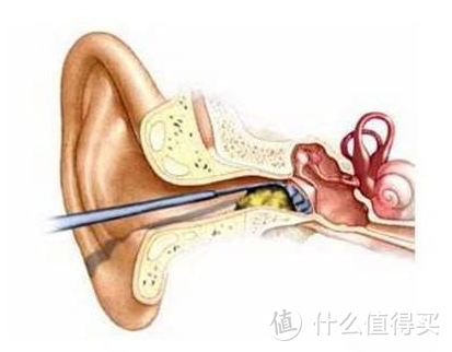 出现耳鸣？不要紧，缓解耳鸣有绝招