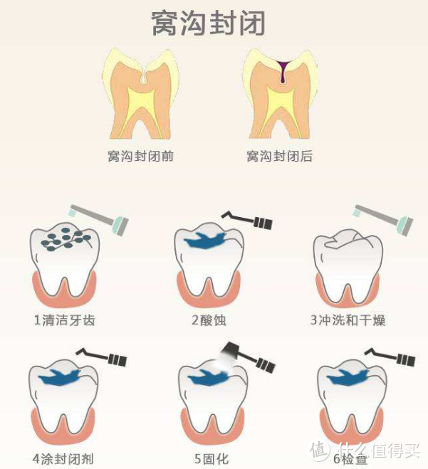 口腔护理界奇葩物牙菌斑显示剂，带你徒手一览牙菌斑现形记