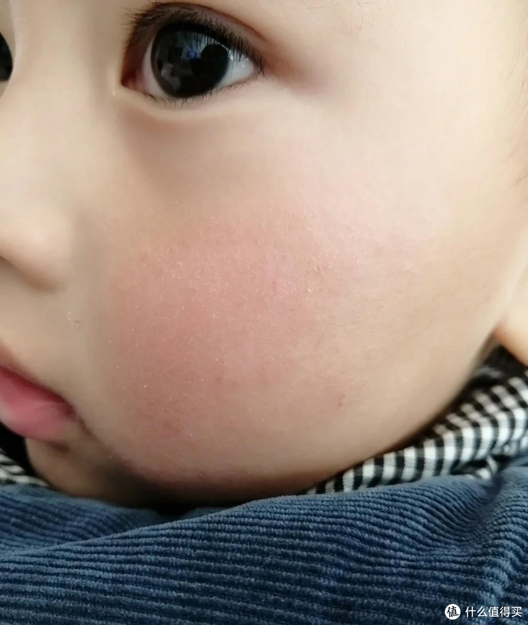 一篇概括宝宝冬季常见问题（便秘、嘴唇干裂、湿疹、苹果脸）应对方法