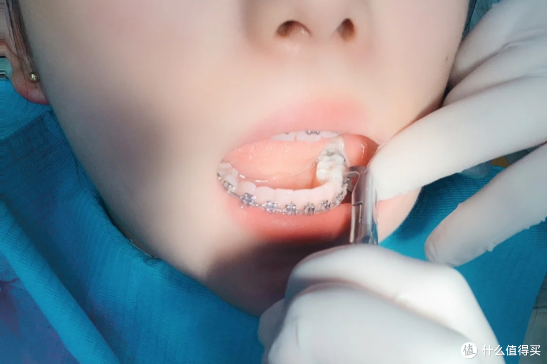 被大数据按头安利的牙粉，真的能美白牙齿吗？