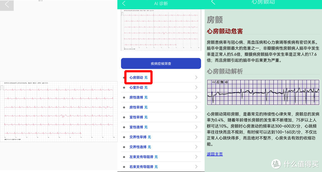 送给妈妈的全面健康管家！dido E10智能手表随时检测血压心电图