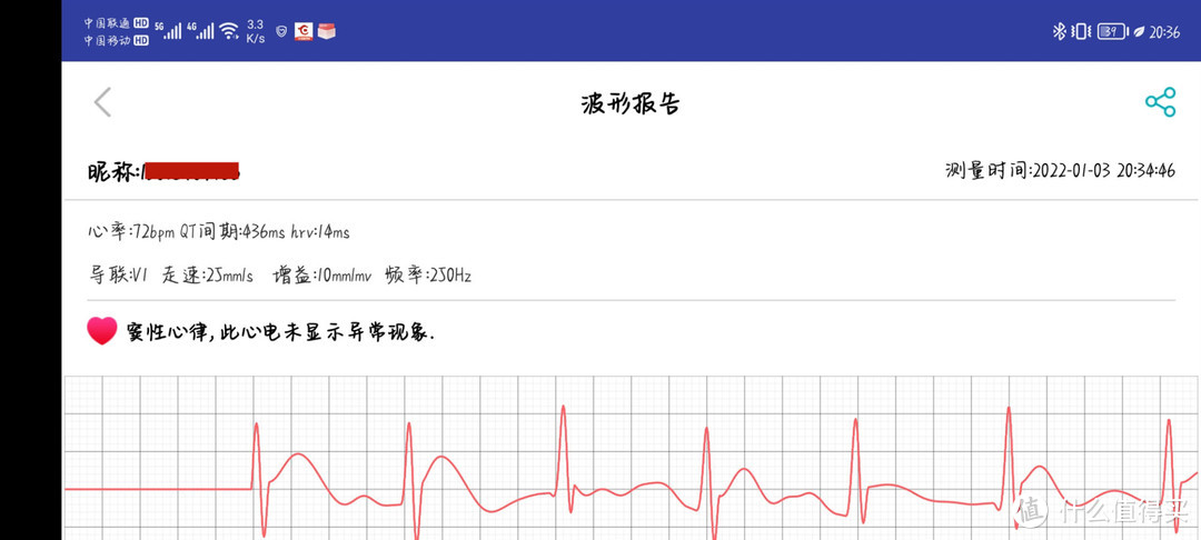 dido Y2手环深度测评，不到400能进行血压心率监测，太强了！