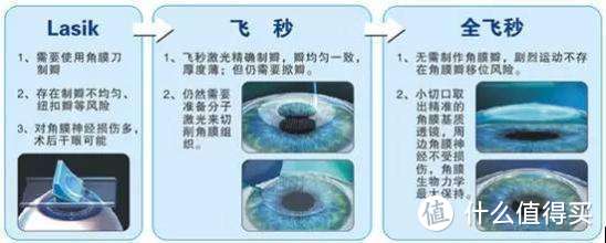 花费1.8万终于下定决心彻底摘掉眼镜——我的全飞秒手术过程和术后情况介绍