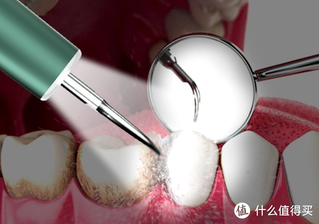 牙齿也有“节后综合症”，针对这些症状你该如何应对？