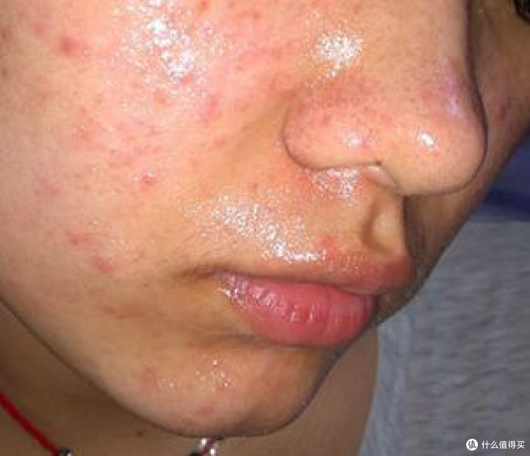 男士油皮护肤自救指南｜型男必备宝藏级男士油皮护肤品推荐