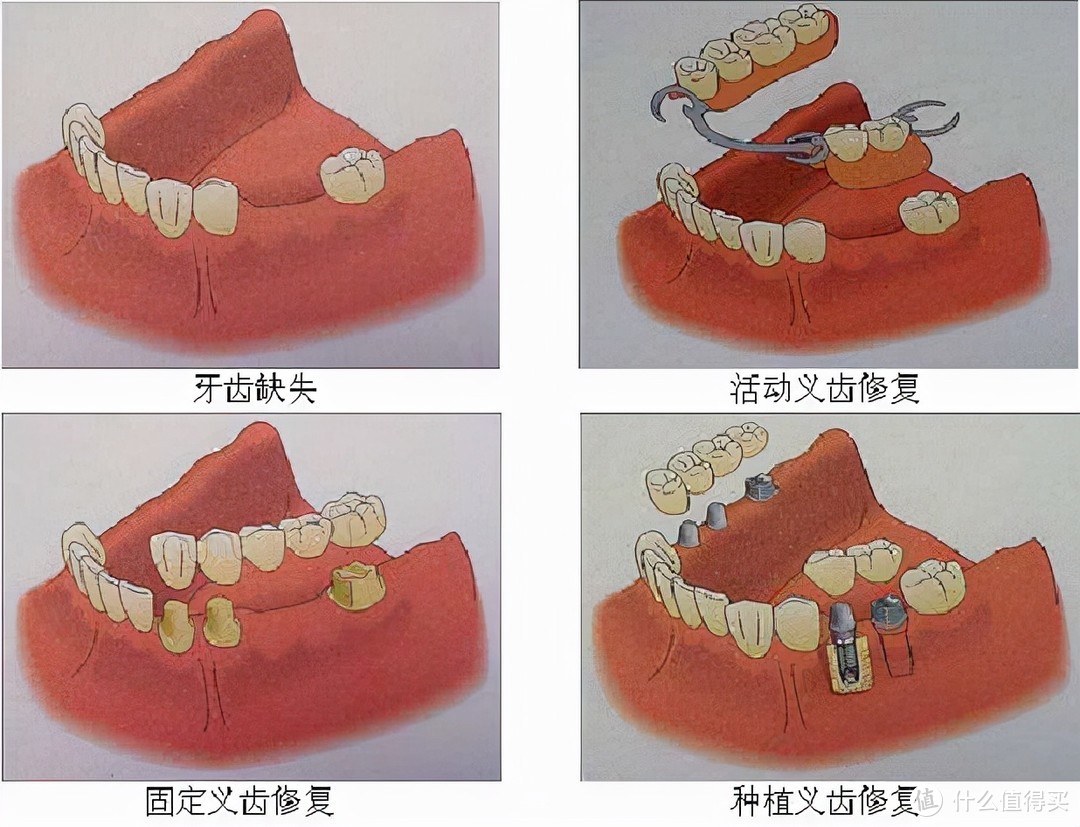 牙齿矫正科普知识，你想知道的都在这里！赶快收藏哦