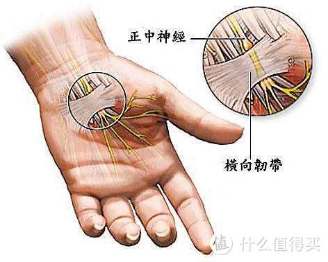 拧毛巾手腕疼？不要简单以为是鼠标手，TFCC（三角纤维软骨复合体）损伤不可大意