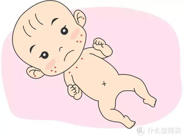 热痱、湿疹、皮肤“淹了”…它们折腾过多少娃！速来了解夏季皮肤护理办法