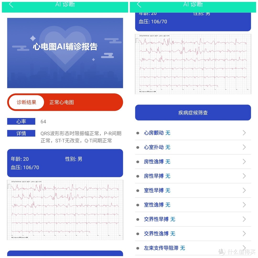 智能手环好推荐，全面健康监测助手didoE10心电血压手表