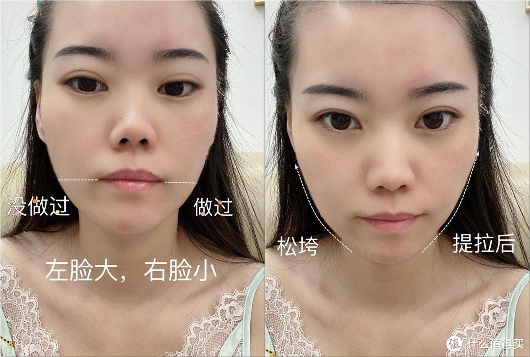射频仪+瘦脸仪真人实测体验，Hashimoto巧本双头美容仪瘦脸、抗衰一台全实现