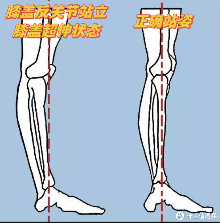 左边站立时的膝盖反关节（超伸状态）往往都是因为腿部力量不足