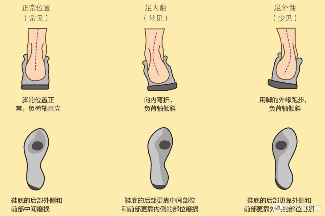 从鞋底的磨损可以判断常见脚落地时内翻外翻