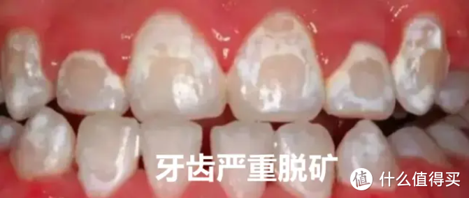 法国regenerate牙膏真的能够修复牙釉质？