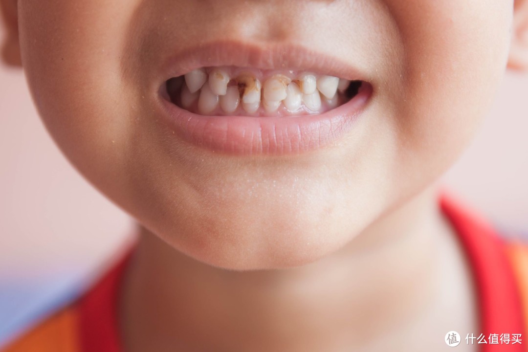 一口好牙从小养成，深度科普乳牙龋齿防护，儿童口腔护理看这篇