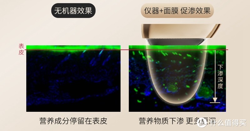 紧致肌肤抚平岁月痕迹，觅光胶原炮S1众测报告