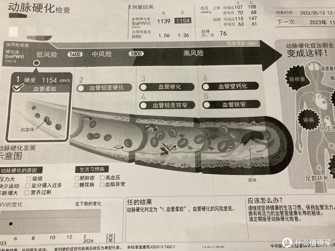 欧姆龙动脉硬化检测