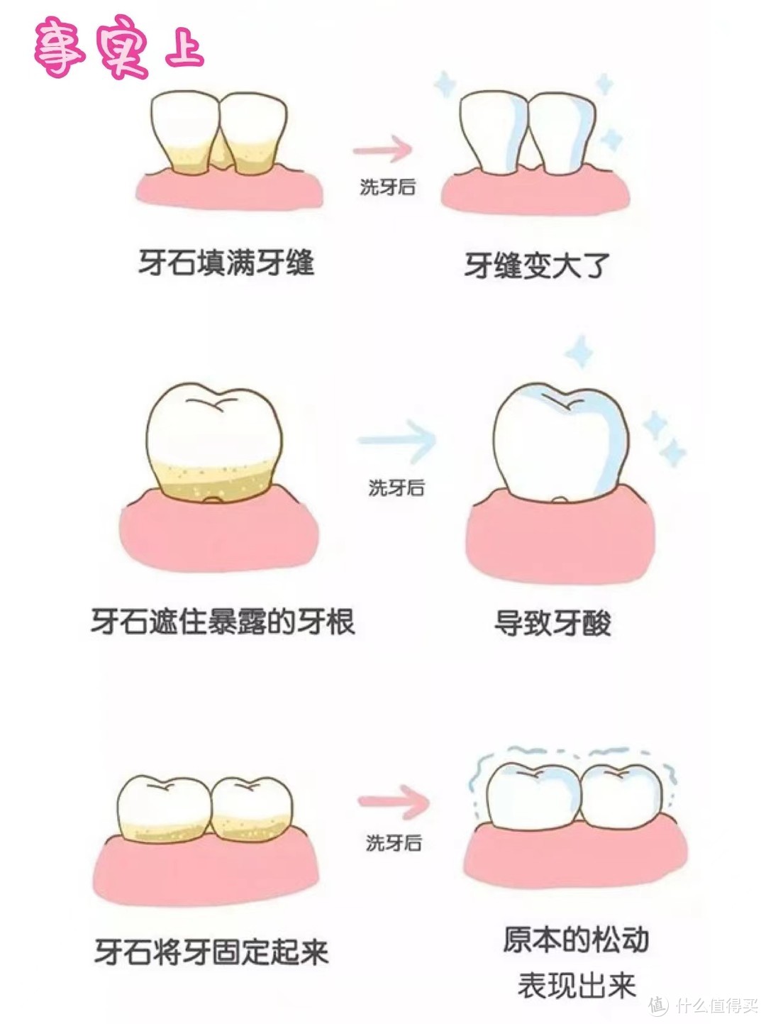 不可不知的洗牙真相！日常护齿真的很重要㊙️