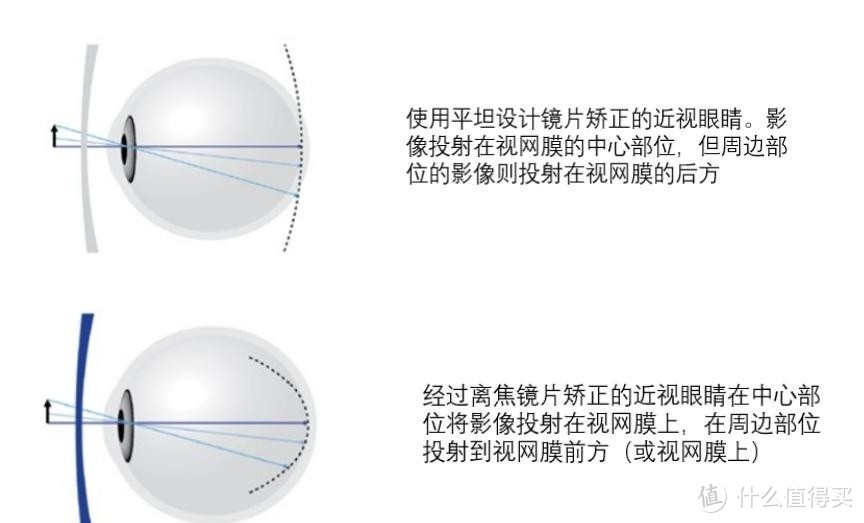 开学啦，你的眼睛准备好了吗？