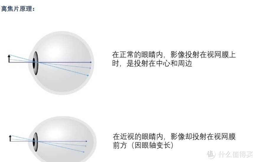 开学啦，你的眼睛准备好了吗？